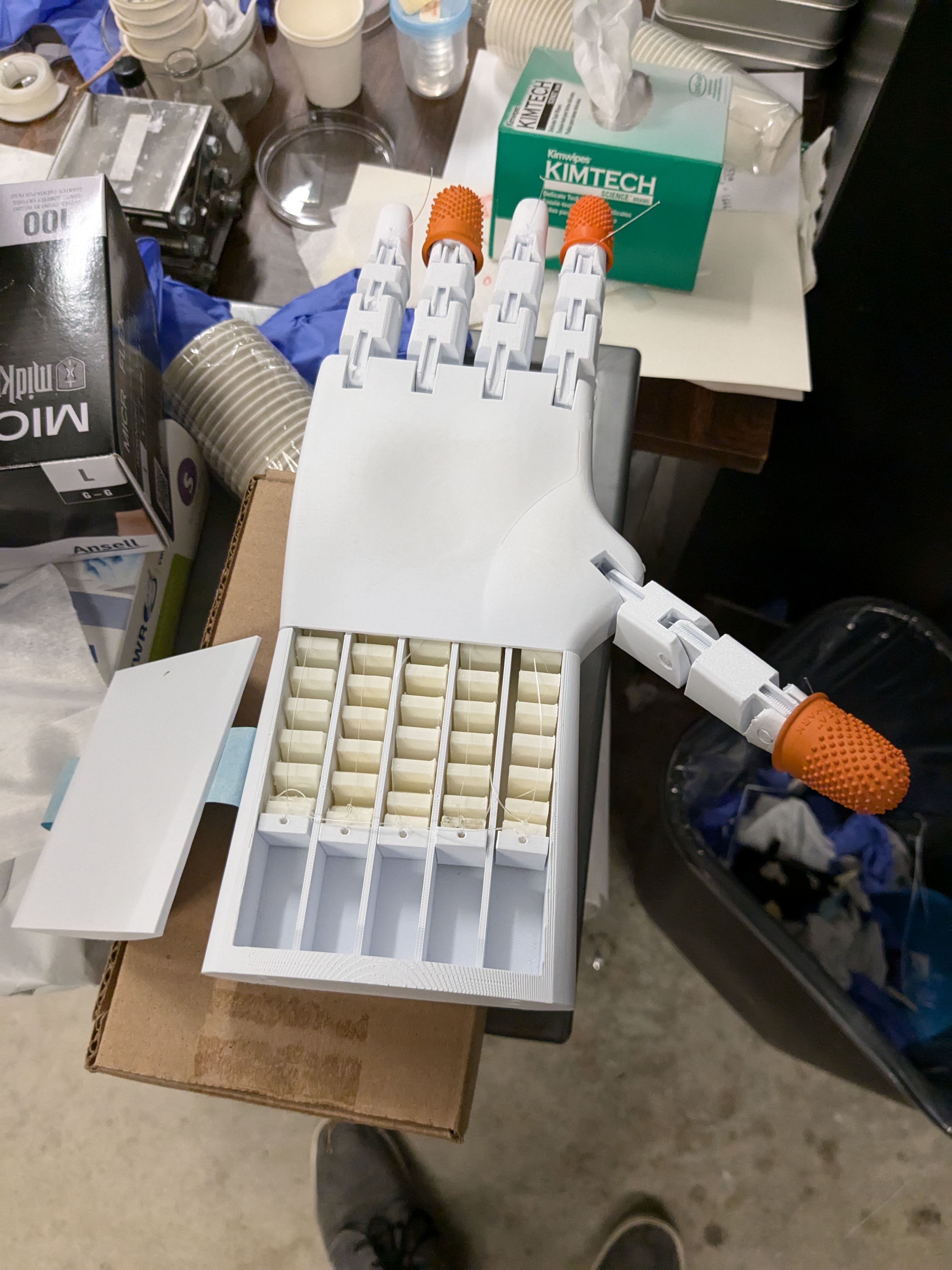 Prosthetic hand prototype with the wrist cover removed, exposing five soft pneumatic actuators and their tendons